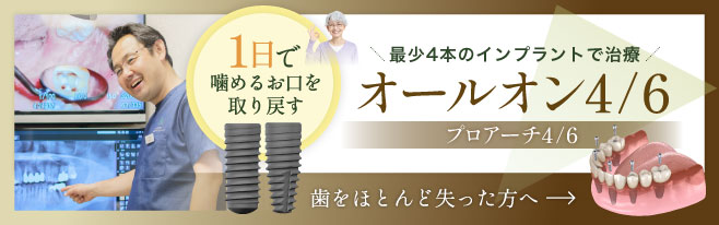 All-on-4/6・プロアーチ4/6 インプラント専門サイト