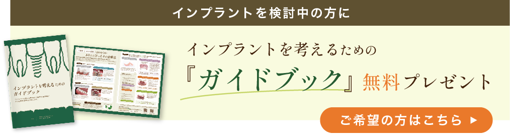 インプラントを考えるための「ガイドブック」無料プレゼント