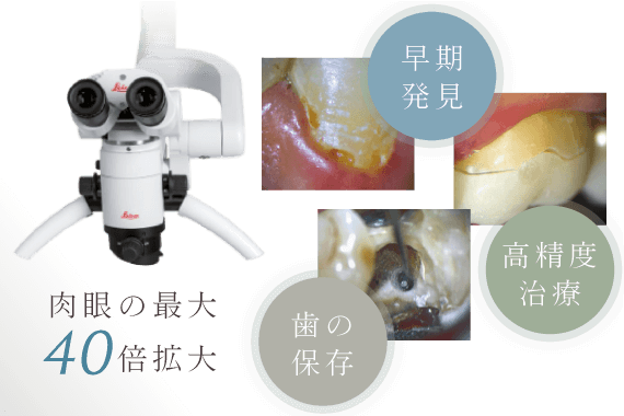 肉眼の最大40倍拡大・早期発見・高精度治療・歯の保存