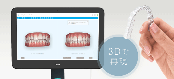 3Dで再現