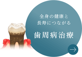 全身の健康と長寿につながる 歯周病治療