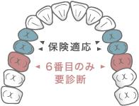 保険適用　6番目のみ要診断