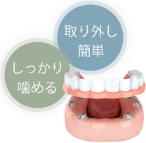 取り外し簡単 しっかり噛める