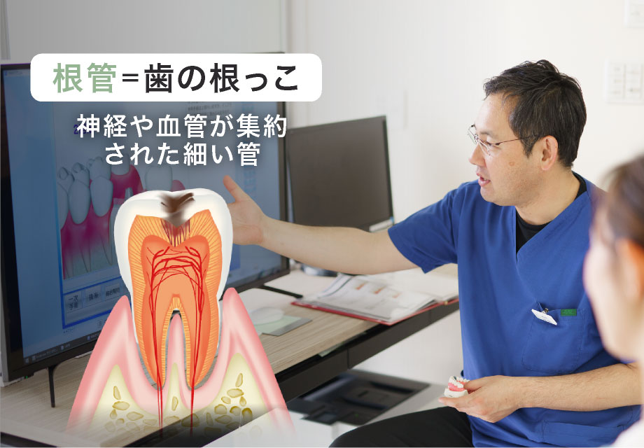 根管=歯の根っこ 神経や血管が集約された細い管